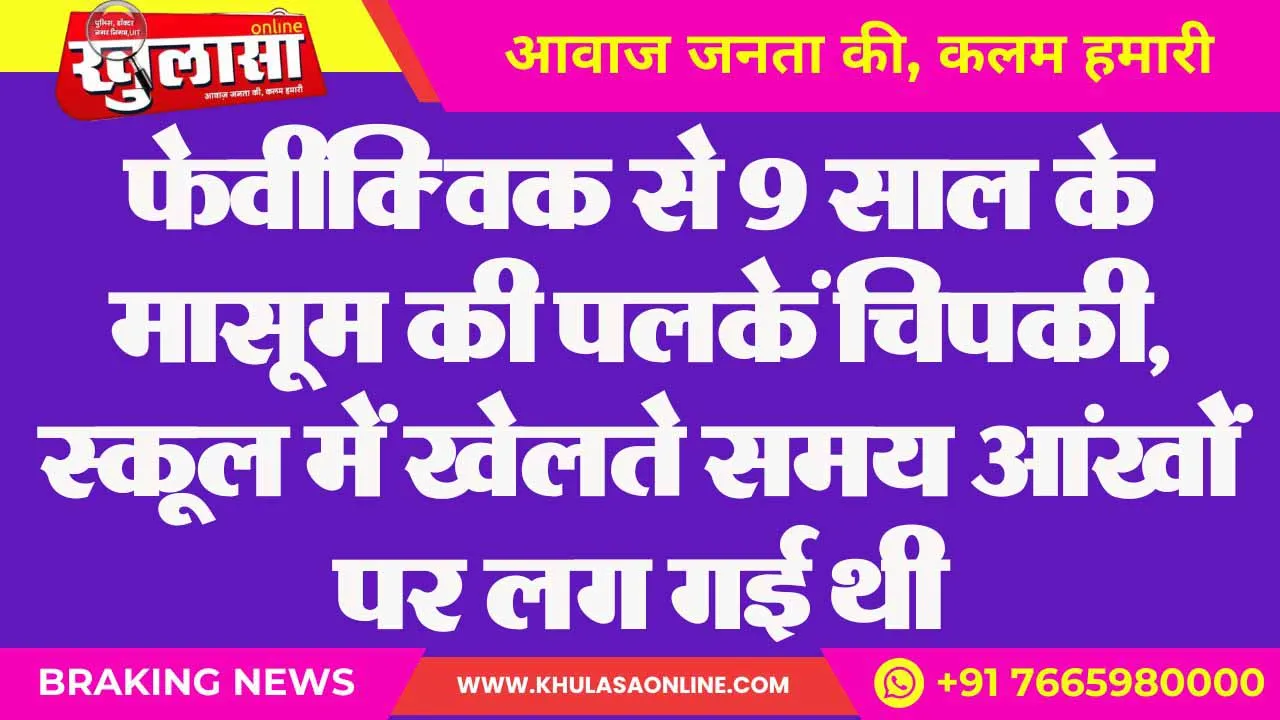 फेवीक्विक से 9 साल के मासूम की पलकें चिपकी, स्कूल में खेलते समय आंखों पर लग गई थी