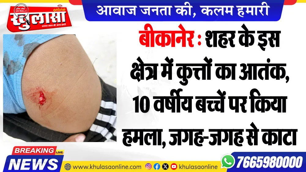 बीकानेर : शहर के इस क्षेत्र में कुत्तों का आतंक, 10 वर्षीय बच्चें पर किया हमला, जगह-जगह से काटा