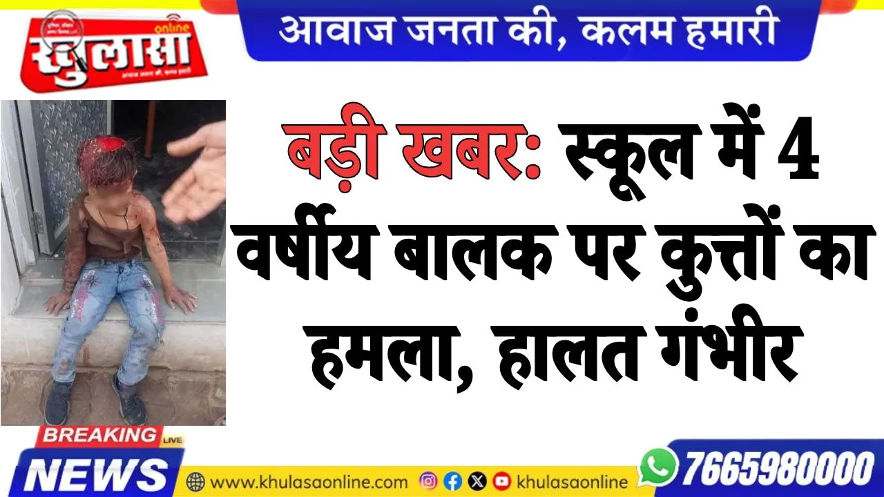 बड़ी खबर:  स्कूल में 4 वर्षीय बालक पर कुत्तों का हमला, हालत गंभीर